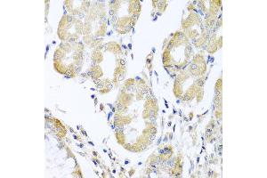 Immunohistochemistry of paraffin-embedded human stomach using ACAD9 antibody at dilution of 1:100 (x40 lens). (ACAD9 Antikörper)