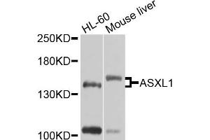 Western blot analysis of extracts of various cells, using ASXL1 antibody. (ASXL1 Antikörper)