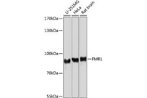 Western blot analysis of extracts of various cell lines, using FMRP antibody (ABIN6133703, ABIN6140719, ABIN6140721 and ABIN6221705) at 1:1000 dilution. (FMR1 Antikörper  (AA 500-600))