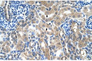 Rabbit Anti-ABP1 Antibody ,Paraffin Embedded Tissue: Human Kidney  Cellular Data: Epithelial cells of renal tubule  Antibody Concentration: 4. (DAO Antikörper  (C-Term))