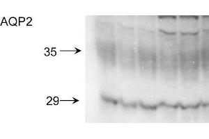 Western blot analysis of Rat kidney inner medullary homogenates showing detection of Aquaporin 2 protein using Rabbit Anti-Aquaporin 2 Polyclonal Antibody . (AQP2 Antikörper  (C-Term) (Atto 390))