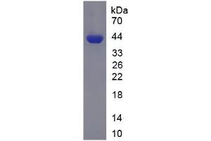 SDS-PAGE analysis of Human PFKL Protein. (PFKL Protein)