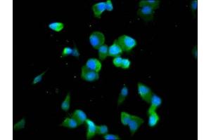 Immunofluorescence staining of SH-SY5Y cells with ABIN7148040 at 1:100, counter-stained with DAPI.