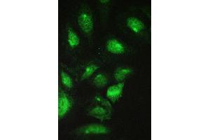 IF analysis of CCT2 using anti-CCT2 antibody (ABIN4886512). (CCT2 Antikörper  (AA 414-535))