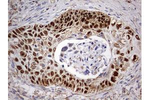 Immunohistochemistry (IHC) image for anti-Tumor Protein P63 (TP63) antibody (ABIN2673817) (p63 Antikörper)