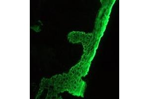 Image no. 2 for anti-pan Keratin (panKRT) antibody (ABIN959483) (pan Keratin Antikörper)