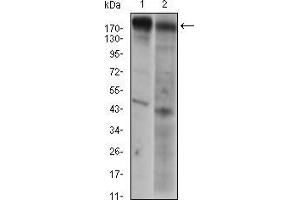 Western blot analysis using EGFR mouse mAb against A431 (1) AND Hela (2) cell lysate. (EGFR Antikörper  (AA 693-893))