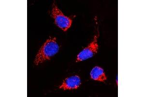 IF analysis of ACACA using anti-ACACA antibody (ABIN7601254). (Acetyl-CoA Carboxylase alpha Antikörper  (AA 31-2336))