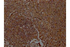 IHC image of ABIN7156538 diluted at 1:100 and staining in paraffin-embedded Human spleen tissue performed on a Leica BondTM system. (ICAM-3/CD50 Antikörper  (AA 200-547))