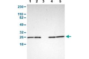 Western Blot analysis of (1) human cell line RT-4, (2) human cell line U-251MG sp, (3) human plasma (IgG/HSA depleted), (4) human liver tissue, and (5) human tonsil tissue. (PARK7/DJ1 Antikörper  (AA 40-177))