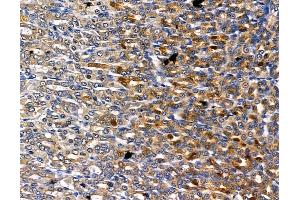 ABIN6260715 and ABIN6278829 at 1/100 staining rat stomach tissue by IHC-P. (CDK5RAP1 Antikörper  (C-Term))