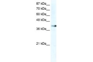 WB Suggested Anti-ZNF556 Antibody Titration:  2. (ZNF556 Antikörper  (C-Term))