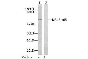 Image no. 2 for anti-Nuclear Factor-kB p65 (NFkBP65) (Ser276) antibody (ABIN197110) (NF-kB p65 Antikörper  (Ser276))