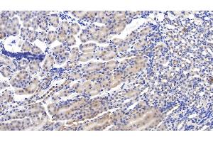 Detection of C1INH in Mouse Kidney Tissue using Polyclonal Antibody to Complement 1 Inhibitor (C1INH) (SERPING1 Antikörper  (AA 397-495))