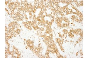 Immunohistochemistry (IHC) image for anti-Early Endosome Antigen 1 (EEA1) (AA 100-150) antibody (ABIN7454791)