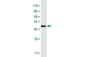 Western Blot detection against Immunogen (36. (MYO1E Antikörper  (AA 918-1014))