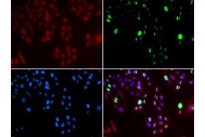 Immunofluorescence analysis of GFP-RNF168 transgenic U2OS cell using FANCD2 antibody. (FANCD2 Antikörper  (AA 1-230))