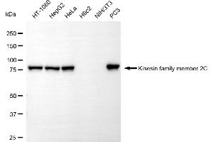 Western blotting analysis using kinesin family member 2C antibody (ABIN7799205). (Rekombinanter KIF2C Antikörper)