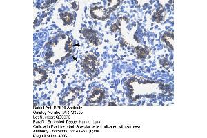 Human Lung (RPS16 Antikörper  (N-Term))