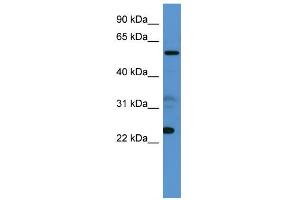 WB Suggested Anti-CPNE9 Antibody Titration: 0.
