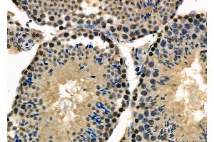 ABIN6264007 and ABIN6277984 at 1/100 staining Mouse testis tissue by IHC-P. (Poly(A) Binding Protein, Cytoplasmic, Pseudogene 2 (PABPCP2) (C-Term) Antikörper)
