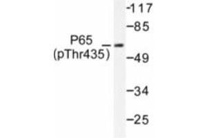 Image no. 1 for anti-Nuclear Factor-kB p65 (NFkBP65) (pThr435) antibody (ABIN318087) (NF-kB p65 Antikörper  (pThr435))