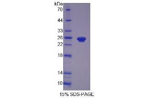 SDS-PAGE (SDS) image for Peroxisomal Biogenesis Factor 1 (PEX1) (AA 62-219) protein (His tag) (ABIN6239200)
