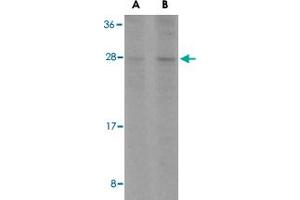 Western blot analysis of BCL2L1 in A-549 cell lysates with BCL2L1 polyclonal antibody  at (A) 1 and (B) 2 ug/mL . (BCL2L1 Antikörper  (C-Term))