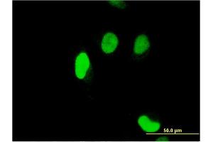 Immunofluorescence of monoclonal antibody to SERTAD1 on HeLa cell. (SERTAD1 Antikörper  (AA 1-236))