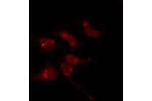 ABIN6274100 staining 293T by IF/ICC. (PHF1 Antikörper  (Internal Region))