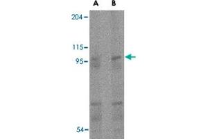 Western blot analysis of TMC6 in human spleen tissue lysate with TMC6 polyclonal antibody  at (A) 1 and (B) 2 ug/mL . (TMC6 Antikörper  (Internal Region))