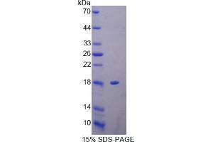 Image no. 1 for Profilin 3 (PFN3) (AA 1-133) protein (His tag) (ABIN6238158)