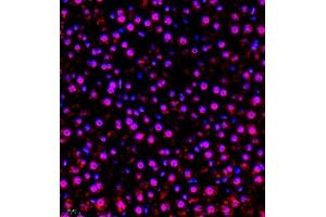 Immunofluorescence of paraffin embedded rat liver using RBAK (ABIN7075383) at dilution of 1:400 (400x lens)