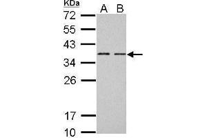 WB Image BCL7A antibody [C2C3], C-term detects BCL7A protein by Western blot analysis. (BCL7A Antikörper  (C-Term))