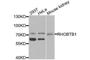 Western blot analysis of extracts of various cell lines, using RHOBTB1 antibody (ABIN6003667) at 1/1000 dilution. (RHOBTB1 Antikörper)