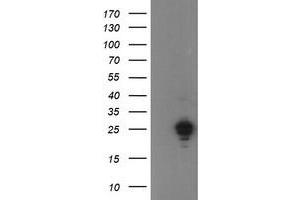 Image no. 1 for anti-Ubiquitin-Conjugating Enzyme E2E 3 (UBE2E3) antibody (ABIN1501621)