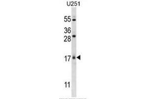 C1orf144 Antibody (N-term) western blot analysis in U251 cell line lysates (35µg/lane). (C1orf144 Antikörper  (N-Term))