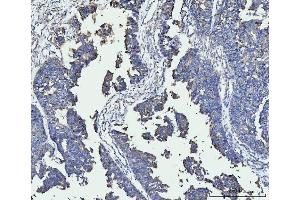 IHC analysis of FACL4/ACSL4 using anti-FACL4/ACSL4 antibody (ABIN7602779). (ACSL4 Antikörper  (C-Term))
