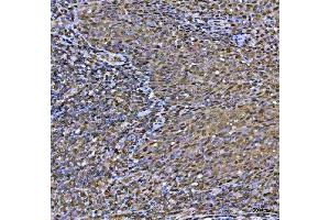 IHC analysis of MAT2A using anti-MAT2A antibody (ABIN7599120). (MAT2A Antikörper  (AA 1-229))