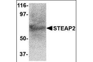 Western blot analysis of STEAP2 in human prostate tissue lysate with this product at 1 μg/ml. (STEAP2 Antikörper  (C-Term))