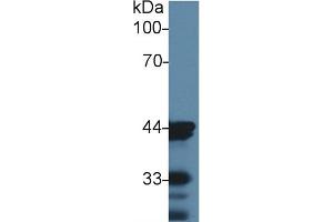 Detection of ACTC1 in Mouse Skin lysate using Monoclonal Antibody to Actin Alpha 1, Cardiac Muscle (ACTC1) (ACTC1 Antikörper  (AA 156-368))