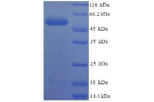 SDS-PAGE (SDS) image for Protease, Serine, 23 (PRSS23) (AA 20-383) protein (His-SUMO Tag) (ABIN5710161)