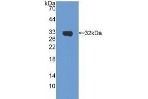 Detection of Recombinant SIRT5, Mouse using Polyclonal Antibody to Sirtuin 5 (SIRT5) (SIRT5 Antikörper  (AA 37-310))