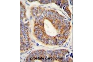 Immunohistochemistry (Paraffin-embedded Sections) (IHC (p)) image for anti-DnaJ (Hsp40) Homolog, Subfamily A, Member 1 (DNAJA1) (AA 294-323) antibody (ABIN652030)