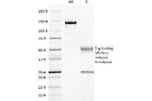 SDS-PAGE Analysis Purified GNAQ Mouse Monoclonal Antibody (GNAQ/2434). (GNAQ Antikörper)