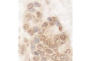 Immunohistochemistry (IHC) image for anti-Glutamine and serine Rich 1 (QSER1) (AA 175-225) antibody (ABIN7453768) (QSER1 Antikörper  (AA 175-225))
