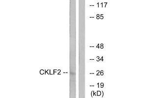 Western Blotting (WB) image for anti-Chemokine-Like Factor (CKLF) (C-Term) antibody (ABIN1851116)