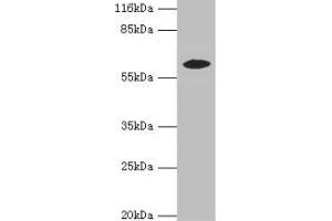 Western blot All lanes: EPHX2 antibody at 2 μg/mL + MCF-7 whole cell lysate Secondary Goat polyclonal to rabbit IgG at 1/10000 dilution Predicted band size: 63, 58, 56 kDa Observed band size: 58 kDa (EPHX2 Antikörper  (AA 1-555))