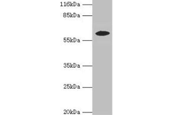 EPHX2 Antikörper  (AA 1-555)