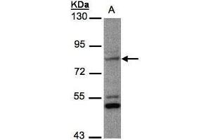 WB Image Sample(30 ug whole cell lysate) A:MOLT4 , 7. (PHEX Antikörper)